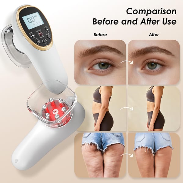 Jingluo Electric Beauty Massager White