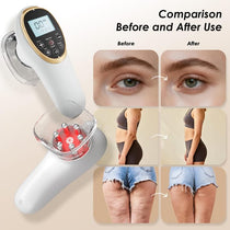 Jingluo Electric Beauty Massager White