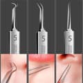 BYXAS Blackhead Remover Tool Kit 11 Piece