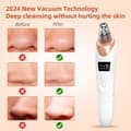 BYXAS Blackhead Remover Tool Kit with Pore Cleaner