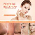 BYXAS Blackhead Remover Tool Kit with Pore Cleaner