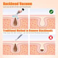 BYXAS Blackhead Remover Tool Kit with Pore Cleaner