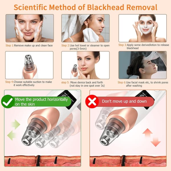 BYXAS Blackhead Remover Tool Kit with Pore Cleaner