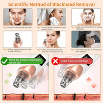 BYXAS Blackhead Remover Tool Kit with Pore Cleaner